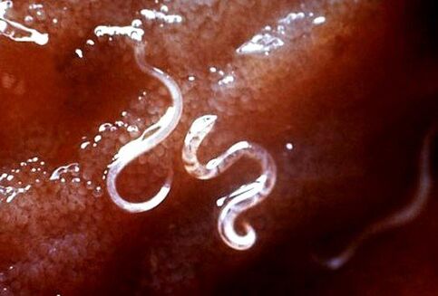 паразити вътре в тялото